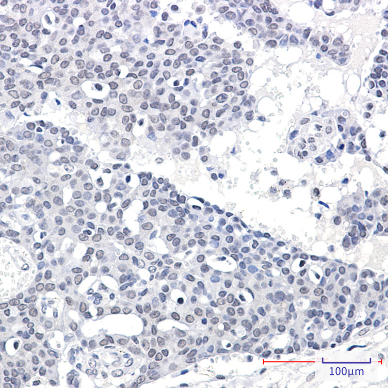 SPT5 Rabbit mAb